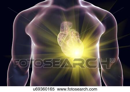 Stock Photography - Heart attack, conceptual illustration. Fotosearch