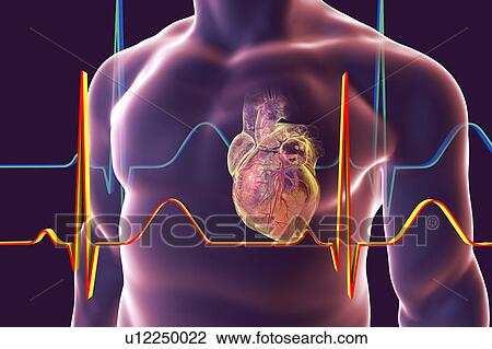 Heart with coronary vessels, illustration View Large Photo Image Stock Image - Heart with coronary vessels, illustration. Fotosearch
