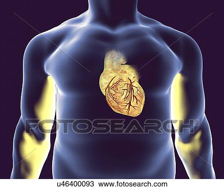 Heart with coronary vessels, illustration View Large Photo Image Stock Image - Heart with coronary vessels, illustration. Fotosearch