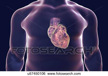 Stock Photograph - Heart with coronary vessels, illustration. Fotosearch