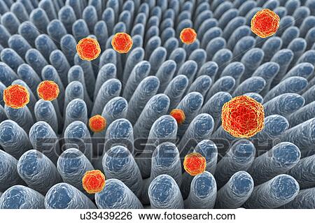 Hepatitis A viruses in intestine, illustration View Large Photo Image Stock Photograph - Hepatitis A viruses in intestine, illustration. Fotosearch