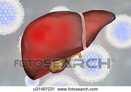 Hepatitis C, illustration View Large Photo Image Stock Image - Hepatitis C, illustration. Fotosearch