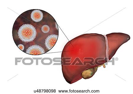 Hepatitis C, illustration View Large Photo Image Stock Photo - Hepatitis C, illustration. Fotosearch