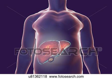 Stock Photo - Human liver, illustration. Fotosearch