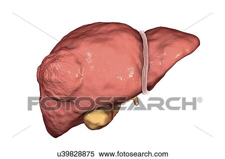 Stock Photography - Liver cancer, illustration. Fotosearch