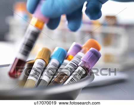 Stock Photo - Medical testing. Fotosearch