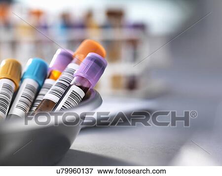 Stock Photo - Medical testing. Fotosearch
