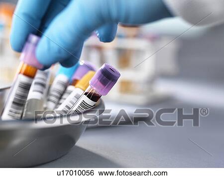 Medical testing View Large Photo Image Stock Photograph - Medical testing. Fotosearch