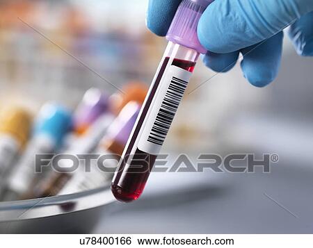 Stock Photograph - Medical testing. Fotosearch