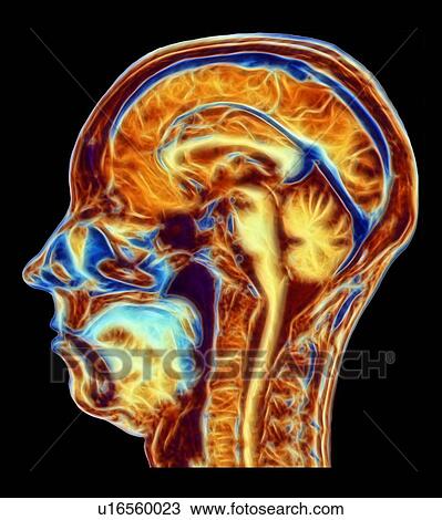 MRI scan of normal brain, artwork View Large Photo Image Stock Image - MRI scan of normal brain, artwork. Fotosearch