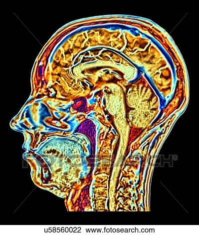 Stock Image - MRI scan of normal brain, artwork. Fotosearch