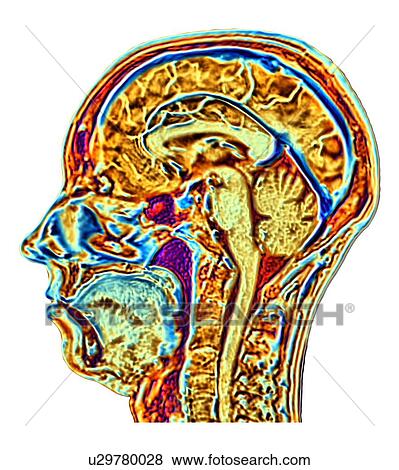 MRI scan of normal brain, artwork View Large Photo Image Stock Photo - MRI scan of normal brain, artwork. Fotosearch
