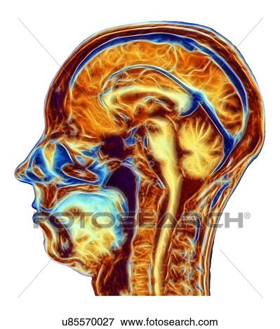 MRI scan of normal brain, artwork View Large Photo Image Stock Photo - MRI scan of normal brain, artwork. Fotosearch