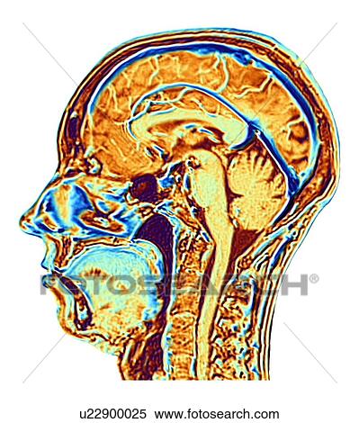 Stock Photography - MRI scan of normal brain, artwork. Fotosearch