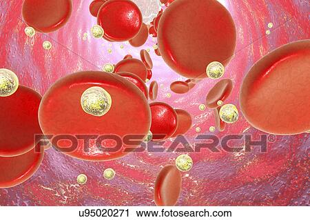 Nanoparticles in blood, illustration View Large Photo Image Stock Image - Nanoparticles in blood, illustration. Fotosearch