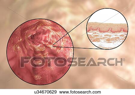 Stock Photo - Oesophagus wall, light micrograph and illustration. Fotosearch