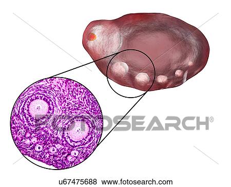 Stock Photo - Ovarian follicles, micrograph and illustration. Fotosearch