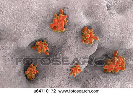 Parasitic amoeba (Entamoeba histolytica) invading intestine, View Large Photo Image Stock Image - Parasitic amoeba (Entamoeba histolytica) invading intestine,. Fotosearch