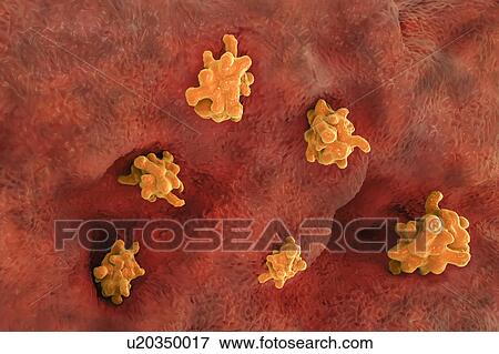 Parasitic amoeba (Entamoeba histolytica) invading intestine, View Large Photo Image Stock Photo - Parasitic amoeba (Entamoeba histolytica) invading intestine,. Fotosearch