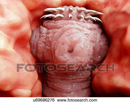 Stock Photograph - Tapeworm head attached to human intestine wall, illustration. Fotosearch