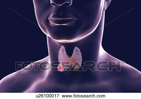Stock Photo - Thyroid gland in a man's neck, illustration. Fotosearch
