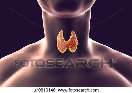 Stock Photograph - Thyroid gland in a man's neck, illustration. Fotosearch
