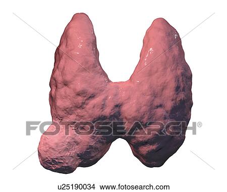 Thyroid gland tumour, artwork View Large Photo Image Picture - Thyroid gland tumour, artwork. Fotosearch