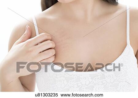 Stock Photography - Woman scratching chest. Fotosearch