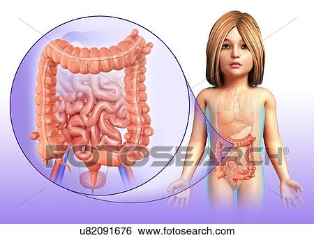 Child with diverticulosis, illustration View Large Photo Image Stock Photograph - Child with diverticulosis, illustration. Fotosearch