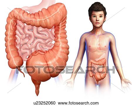 Stock Image - Child with mega colon, illustration. Fotosearch