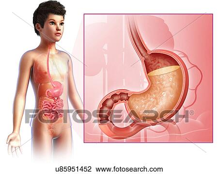 Child with stomach acidity, illustration View Large Photo Image Stock Image - Child with stomach acidity, illustration. Fotosearch