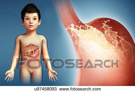 Child with stomach acidity, illustration View Large Photo Image Stock Image - Child with stomach acidity, illustration. Fotosearch