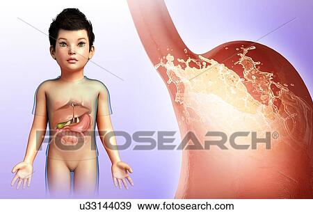Stock Photo - Child with stomach acidity, illustration. Fotosearch