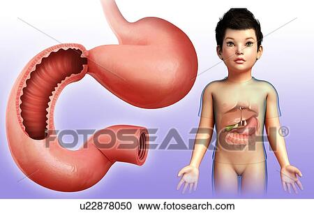 Stock Image - Child's duodenum, illustration. Fotosearch