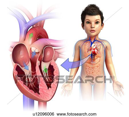 Stock Photograph - Child's heart chambers, illustration. Fotosearch