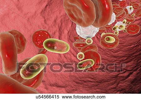 Stock Photography - Chitosan nanoparticles in blood, illustration. Fotosearch
