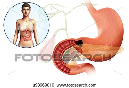 Gallbladder, duodenum and pancreas, illustration View Large Photo Image Stock Image - Gallbladder, duodenum and pancreas, illustration. Fotosearch