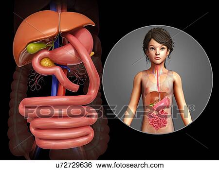 Stock Photograph - Gastric bypass, illustration. Fotosearch
