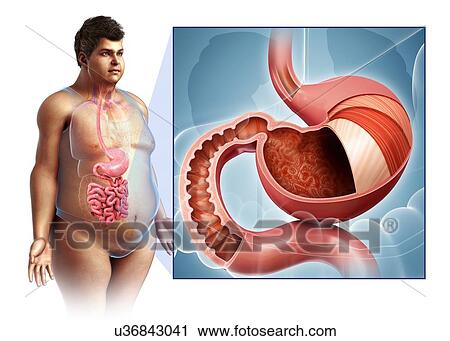 Stock Image - Male stomach layers anatomy, illustration. Fotosearch