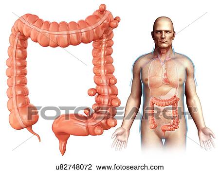 Man with diverticulosis, illustration View Large Photo Image Stock Image - Man with diverticulosis, illustration. Fotosearch