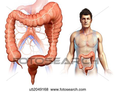 Stock Photo - Man with mega colon, illustration. Fotosearch