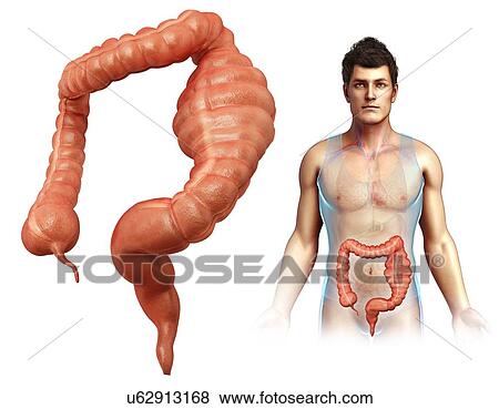 Man with mega colon, illustration View Large Photo Image Stock Photo - Man with mega colon, illustration. Fotosearch