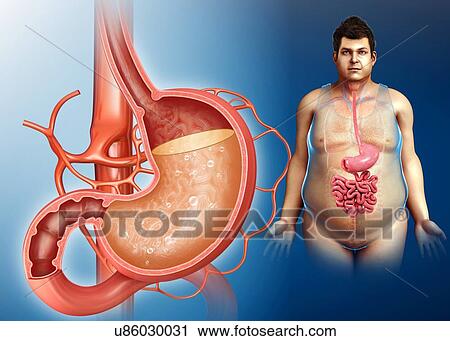 Stock Image - Man with stomach acidity, illustration. Fotosearch