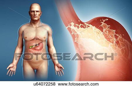 Man with stomach acidity, illustration View Large Photo Image Stock Photo - Man with stomach acidity, illustration. Fotosearch