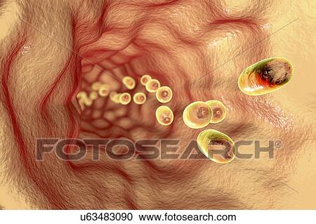 Stock Image - Medicines in oesophagus, illustration. Fotosearch