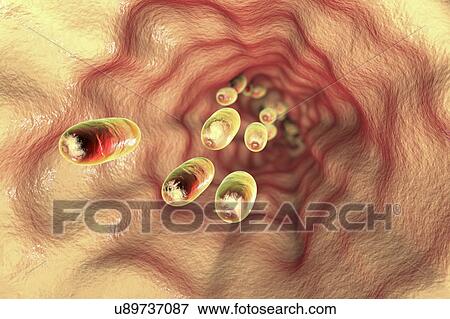 Medicines in oesophagus, illustration View Large Photo Image Stock Photo - Medicines in oesophagus, illustration. Fotosearch