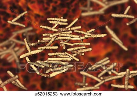 Stock Image - Mycobacterium avium bacterium, illustration. Fotosearch