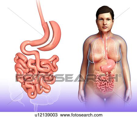 Sleeve gastrectomy, illustration View Large Photo Image Stock Image - Sleeve gastrectomy, illustration. Fotosearch