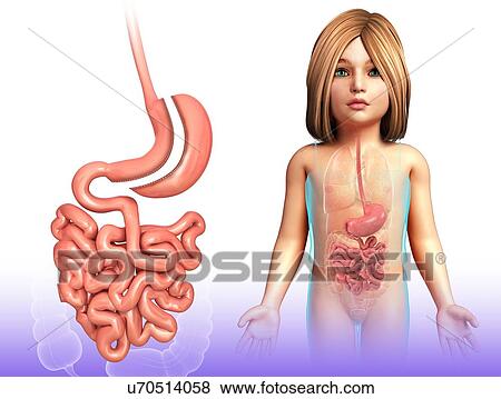 Stock Photo - Sleeve gastrectomy, illustration. Fotosearch