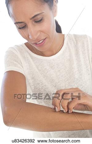 Stock Image - Woman scratching arm. Fotosearch